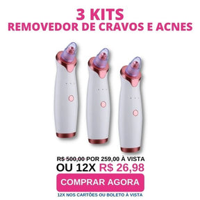 Removedor de Cravos Acnes e Óleo Especially + Frete Grátis + Envio Imediato + Brinde