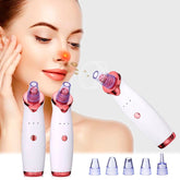 Removedor de Cravos Acnes e Óleo Especially + Frete Grátis + Envio Imediato + Brinde